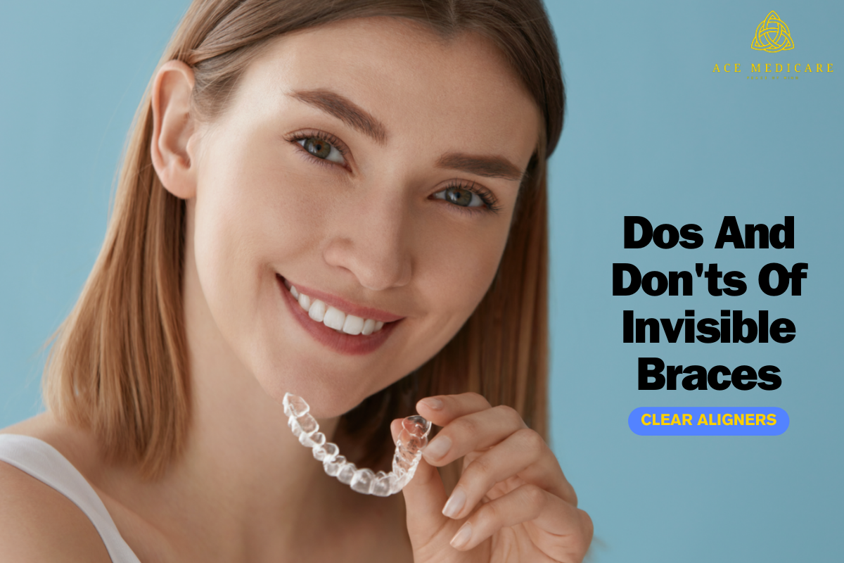 The Dos And Don'ts Of Invisible Braces: Clear Aligners